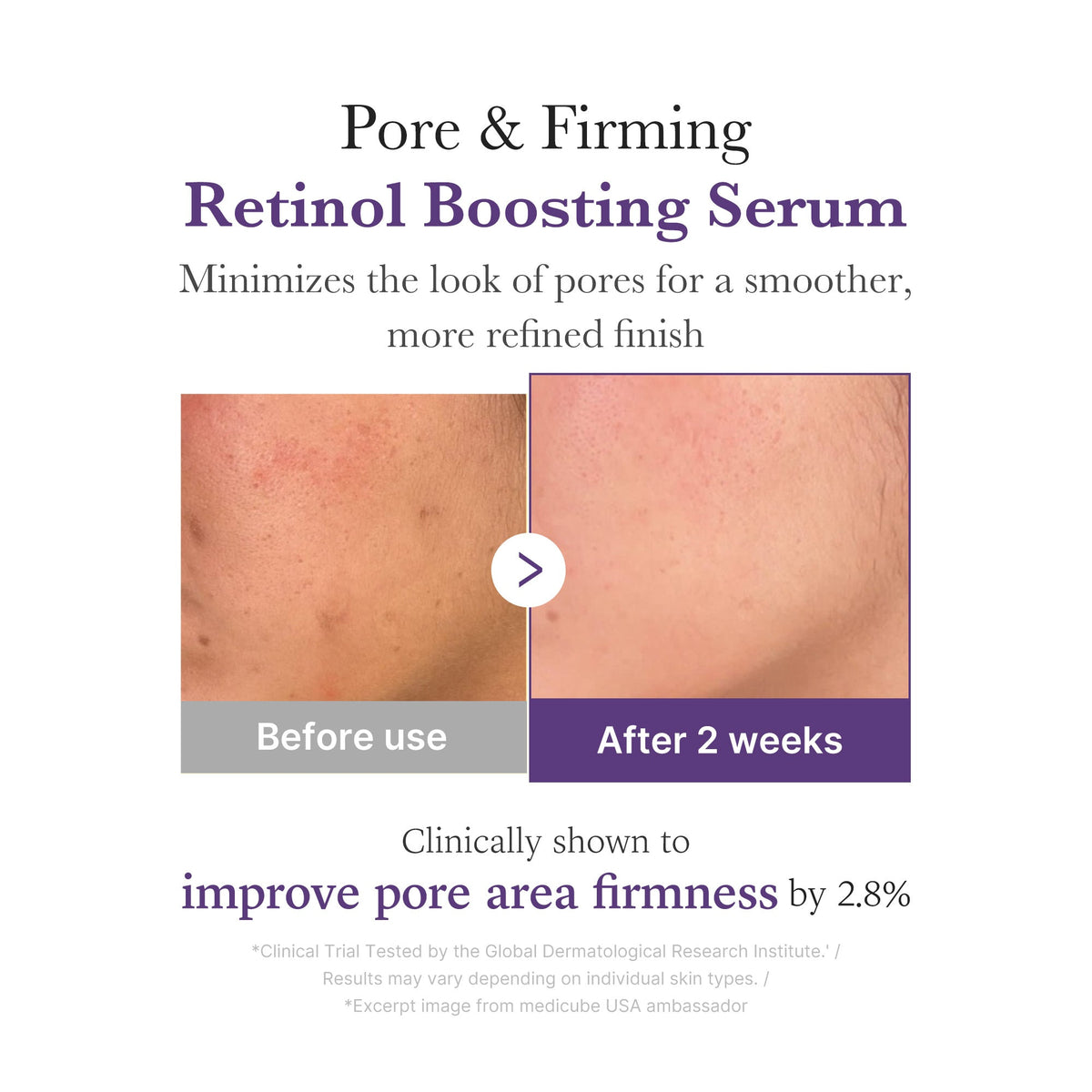 Medicube Retinol NMN Boosting Serum 30ml 4