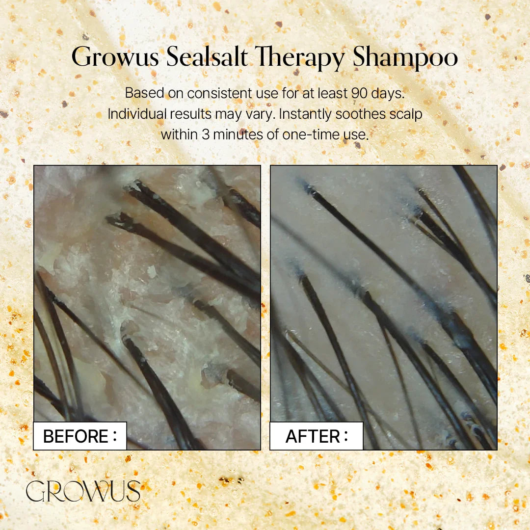 GROWUS Sea Salt Therapy Shampoo 500g 5